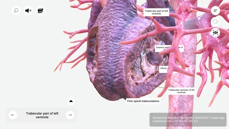 Left ventricle trabecular part 360-degree interactive viewer showing trabeculae carneae and muscular ridges